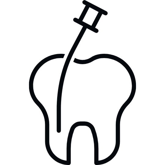 wurzelbehandlung